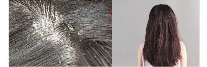 茶氏家族-山茶籽調理精油 茶氏家族-山茶籽調理精油