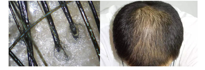 茶氏家族-山茶籽調理精油 茶氏家族-山茶籽調理精油