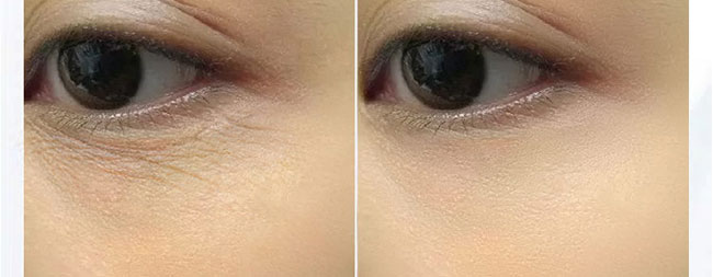 ���������o(h��)˪