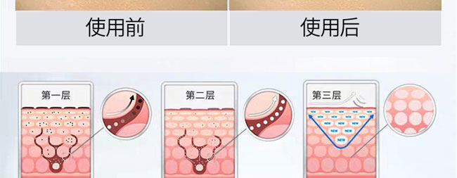 ���������o(h��)˪