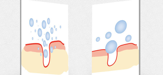 �������ʲ����o(h��)ԭҺ