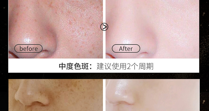 ϧ��܎����݌���