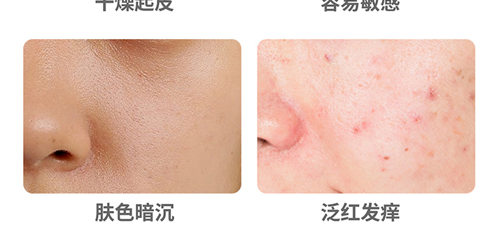 高地保濕修護(hù)霜 高地保濕修護(hù)霜